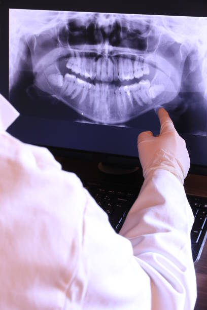 Best Root Canal Emergency Dentist  in Hohenwald, TN